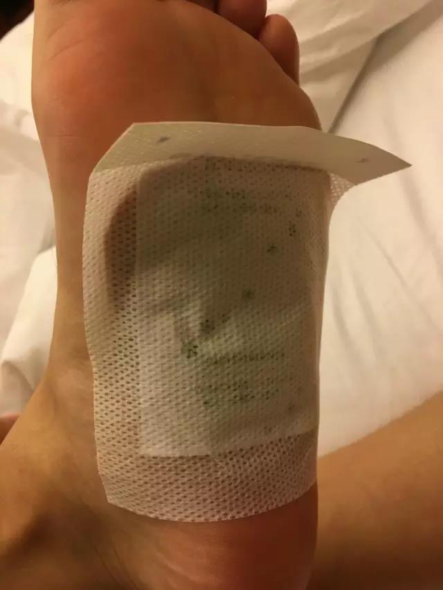 随后将足贴贴到脚掌上 随后将足贴贴到脚掌上