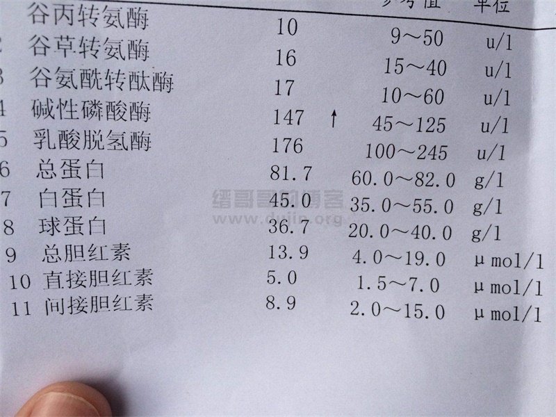 为什么要体检?哪些项目?注意事项 为什么要体检?哪些项目?注意事项