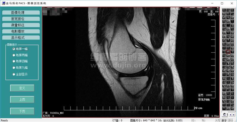 用金马扬名PACS影像浏览器打开核磁共振或CT文件 用金马扬名PACS影像浏览器打开核磁共振或CT文件