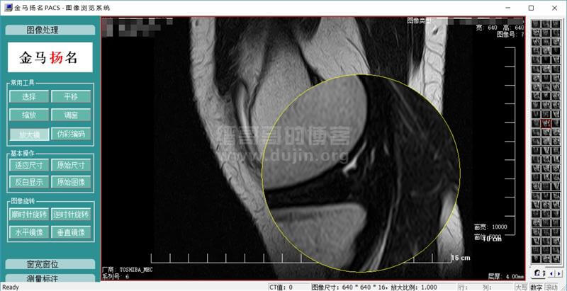 用金马扬名PACS影像浏览器打开核磁共振或CT文件 用金马扬名PACS影像浏览器打开核磁共振或CT文件